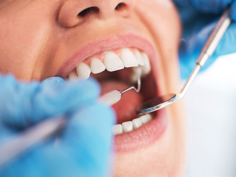 Dental Cleaning