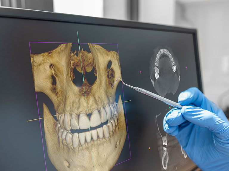 3D Scan